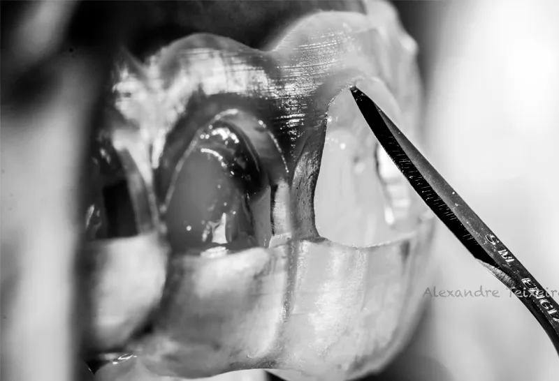 Imagem do curso de Master em Cirurgia Periodontal Estética