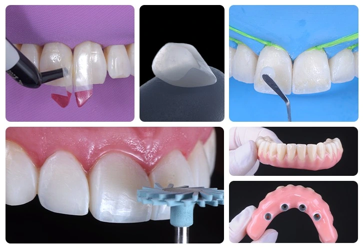 Imagem do curso de Dentística-Prótes