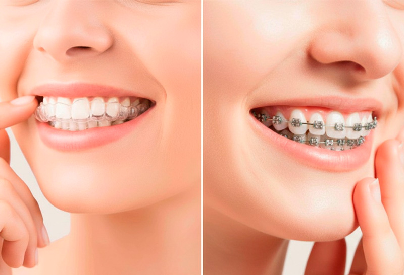 Imagem do curso de Ortodontia