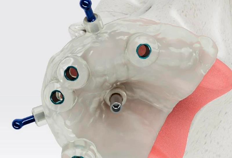 Imagem do curso de Credenciamento em Cirurgia Guiada